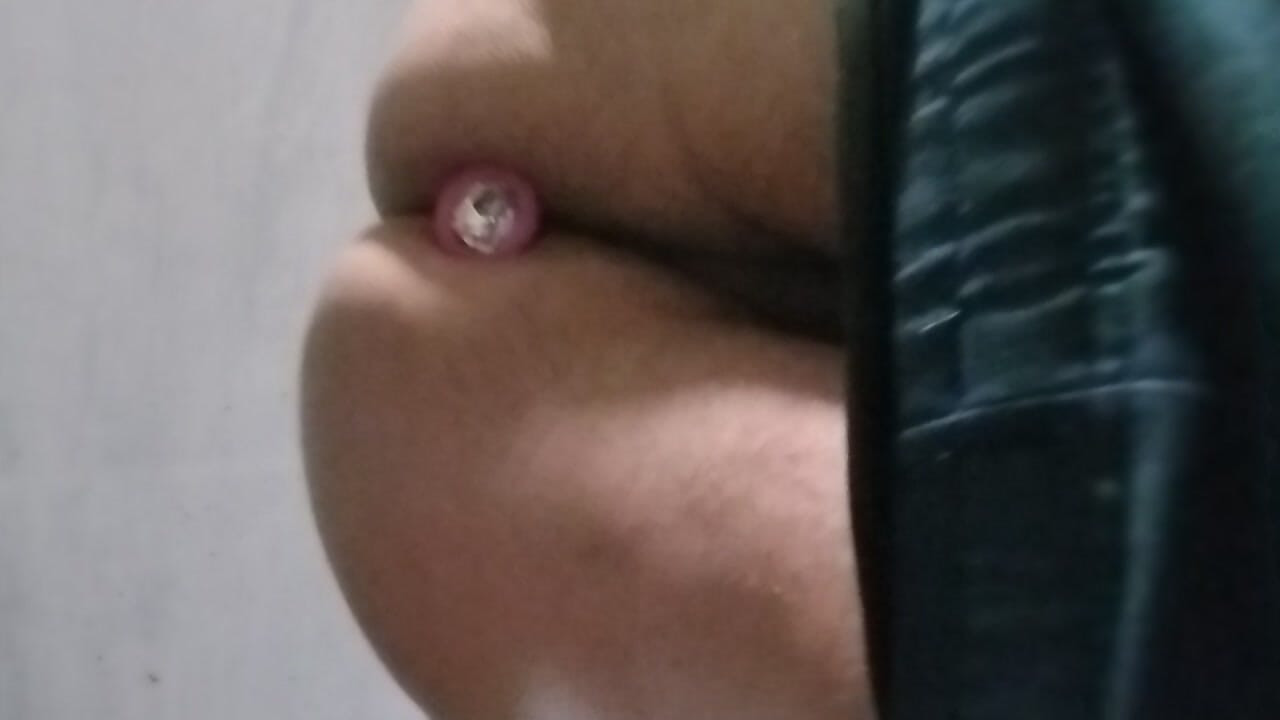 屁股上的东西