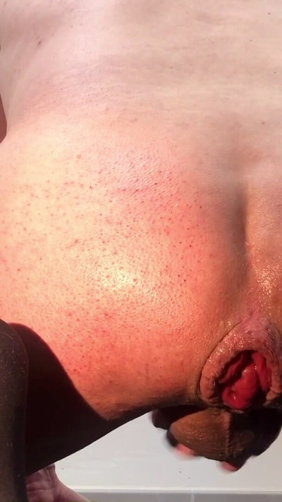beautiful ass and dilated anus to receive sperm - anal prolapse | Clip 1