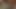 LizzyYum VR december 2023 (cuffed) Post Op Orgasm Pussy Masturbation Teasing