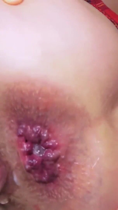 Detik utama dari kompilasi creampie dubur oleh NatalieFlowers"