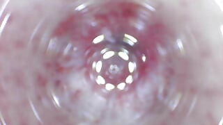Looking into the urethra