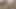 Lizzy Yum July 2023 JUST my VIBRATOR Post-Op Orgasm Pussy Clit Masturbation Teasing Orgasm