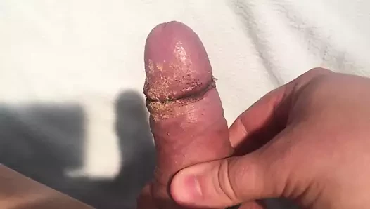 Temizlemeden iki hafta sonra smegma ve kir