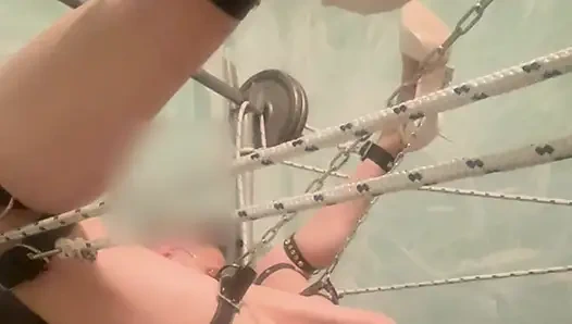 Banding no move anal