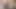 ssbbw ampute