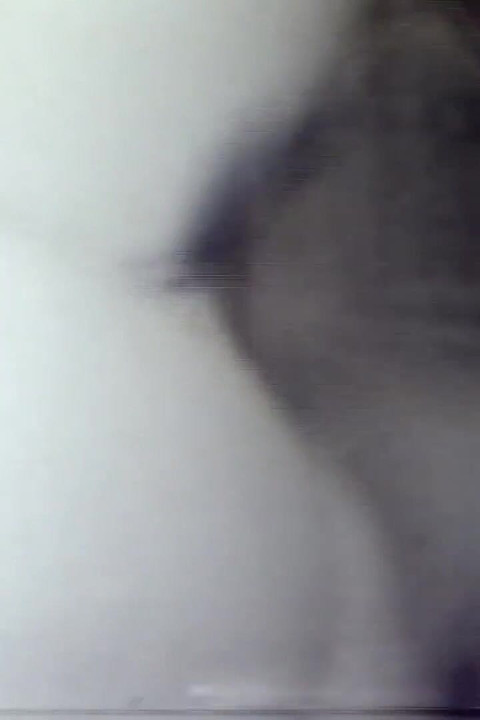 चूसने वालों का समूह