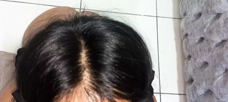 Bandaged stepmom fucks her stepson thinking he's her husband