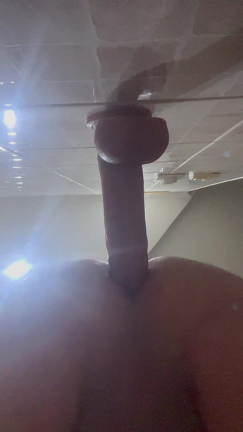 anal