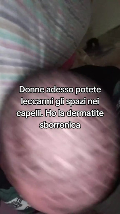 The tik tok master suffers from dermatitis