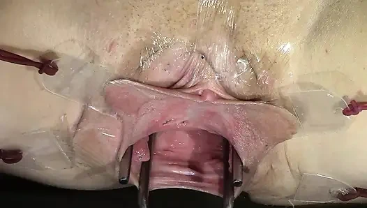 Weit Gespreizte Muschi Noch Weiter Geöffnet Und Mit Dildo, Der Nah Arbeitet, Blickte Hinein Und Spritzte