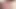 Extreme close up of my sticky wet foreskin and urethra post-cum