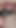 "Genç bir deliği yok etme" den ağzı açık bırakma anı