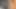 Mega-Spermalöcher – Teil 1