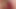 Penetration uretrale masturbation ejaculation