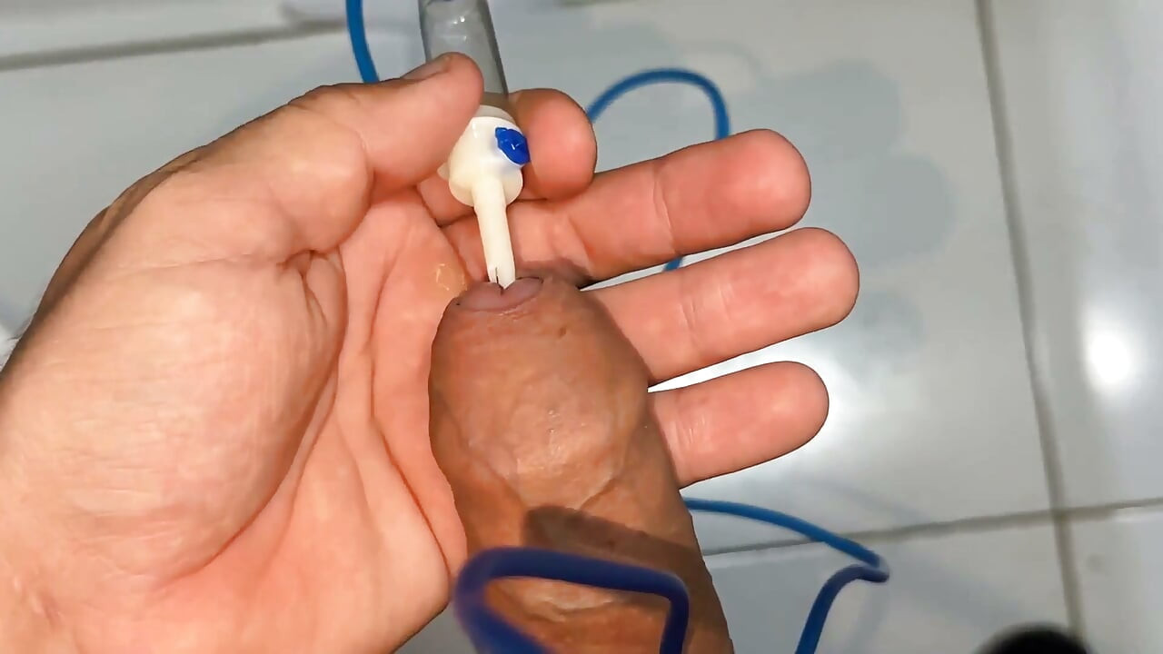 Sounding Extreme Sharp Probing in the Urethral Canal