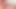 Extreme cock urethra stuffed full. Extreme urethral multisounding. Multiple sounds in cock urethra.