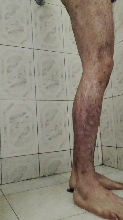 Moje noge pod tušem, kiša