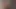 Kocamın yeni oyuncağı, prostat oyuncağı.