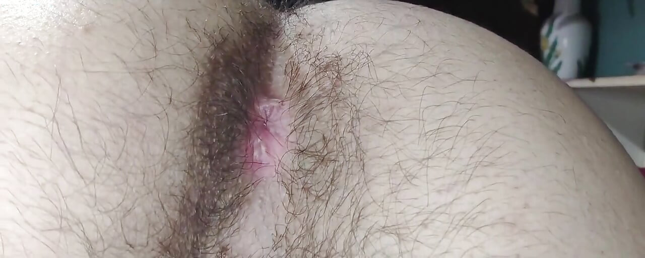 An Extreme Close-up of a Super Hairy Butt. I Haven't Cleaned Myself up Very Well, It Seems