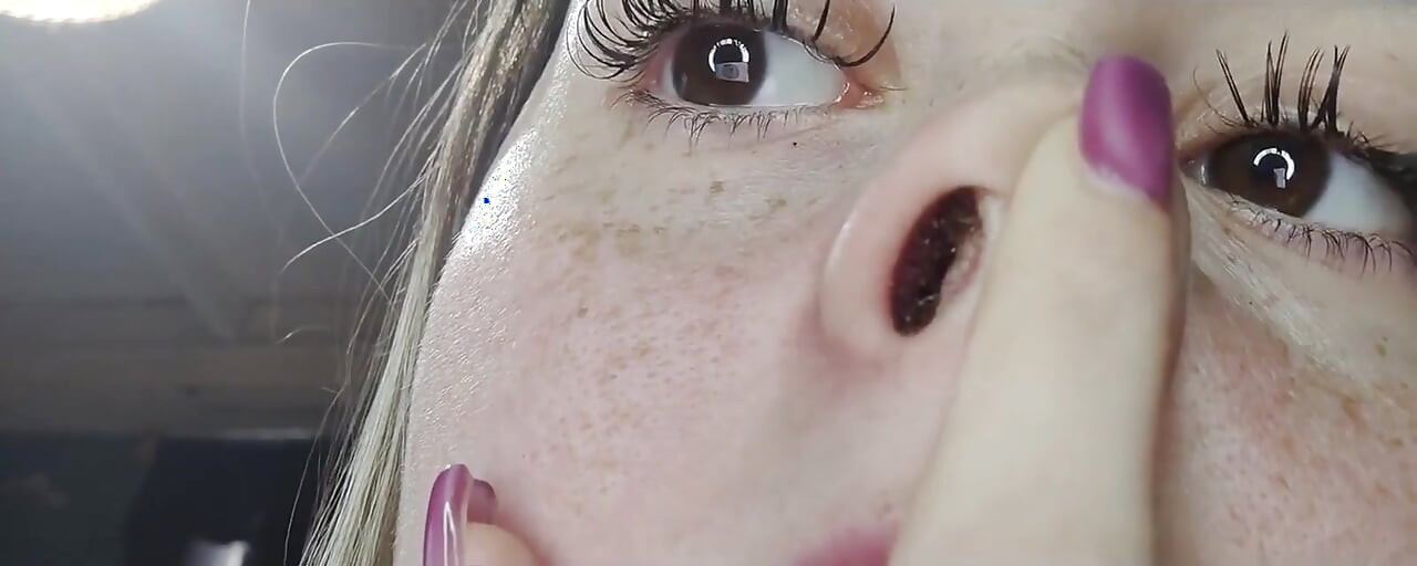 Runny Nose Close up