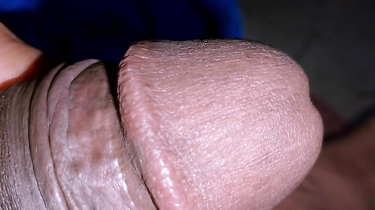 Long hair of penis
