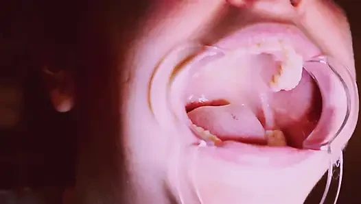 Preparing for Invisible Aligners