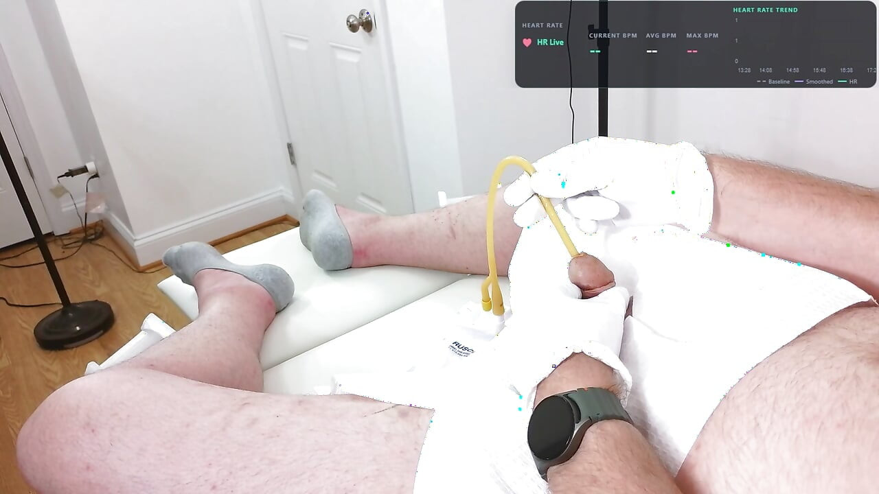 Zen 20 French Foley catheter insertion