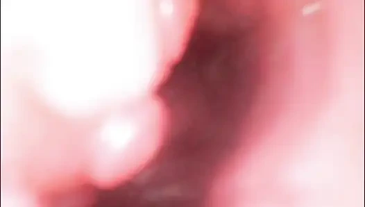 Endoscope Creampie. Cam Inside Pussy Shows Dick Cumming Inside Pussy