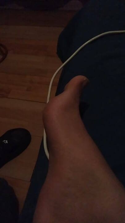 Moje noge za tebe