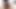 Lizzy Yum SD August 2025 Dilating #25