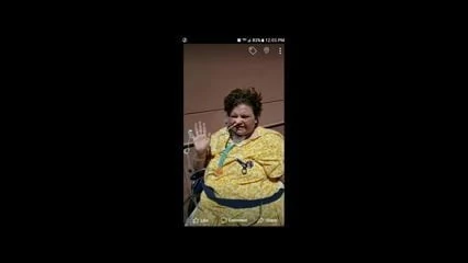 amputee bbw
