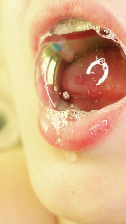 Spectacular moment from "braces mouth tour video - vore fetish"