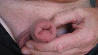 Swollen cock after nettles treatment oin foreskin