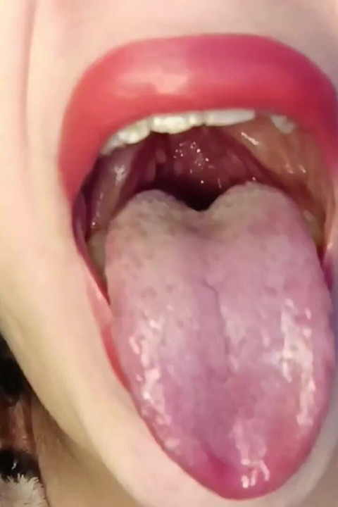 Consume Chews Gummies
