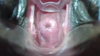 Flache Gebärmutterhals-Penetration