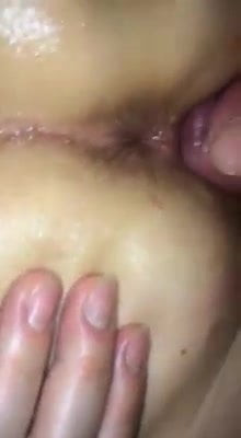 Anal