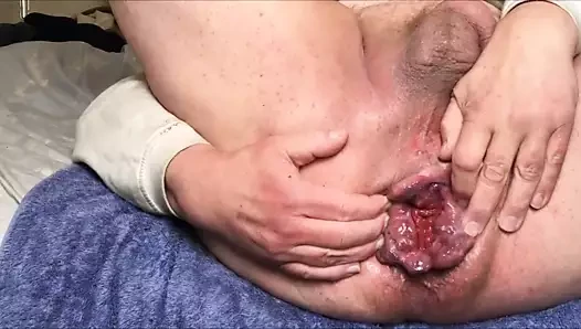krem yakın çekim anal esneme oturum 1 arasında 3