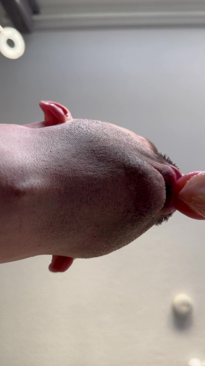It is important to moisturize the lips!
