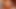 Masturbation