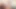 Interracial-i Find a Huge Cock in My Patient's Checkup and I Crave to Give Him a Juicy Blowjob.