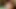 A light bulb in my anal