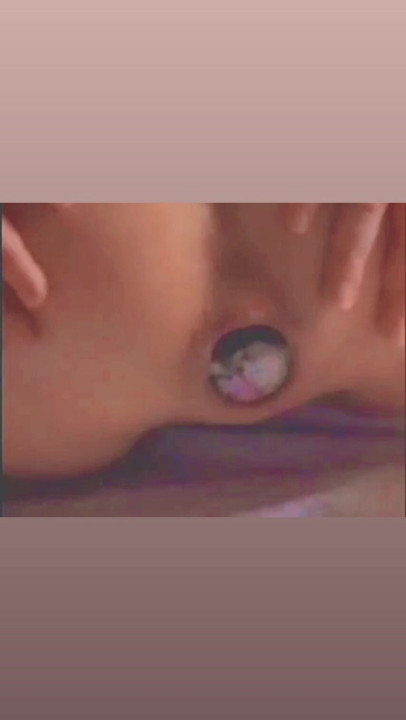 엉덩이에 공