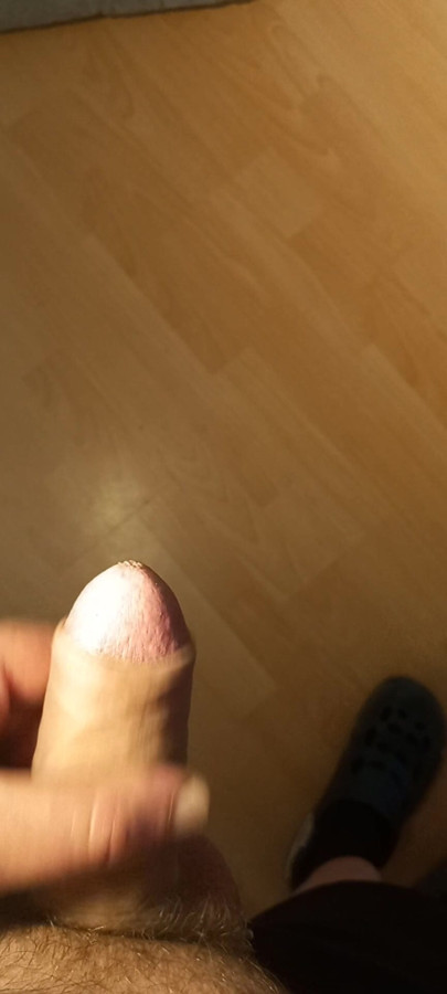 Penis