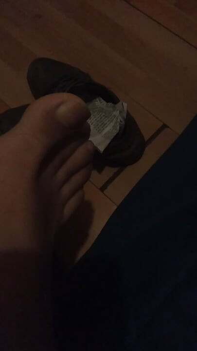 My soles of my feet