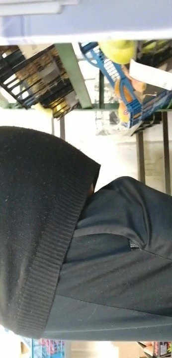 Umflătură tare foarte mare 2