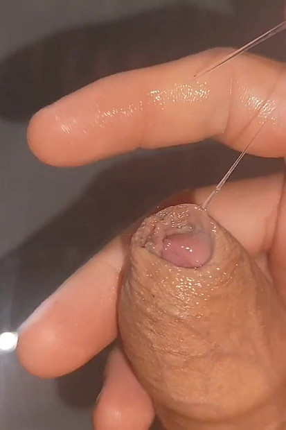 Бурный Хриплый Венозный В Неконтролируемом Оргазме.