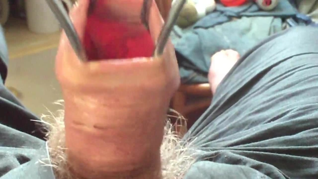 Cum in foreskin