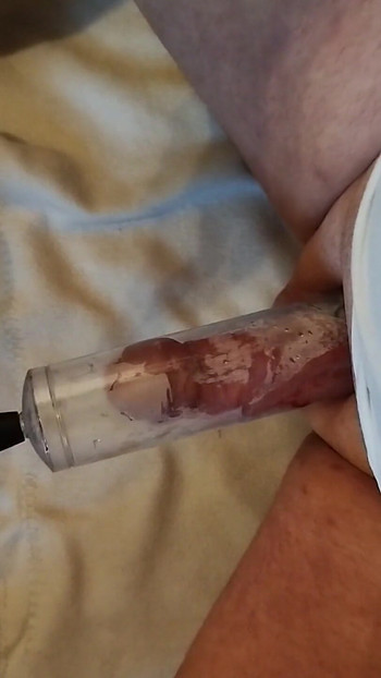 Penis Pump
