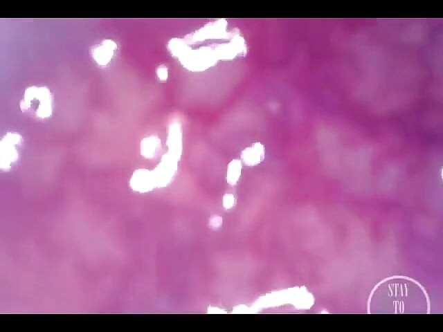 POV Extreme Deep Anal Examination!