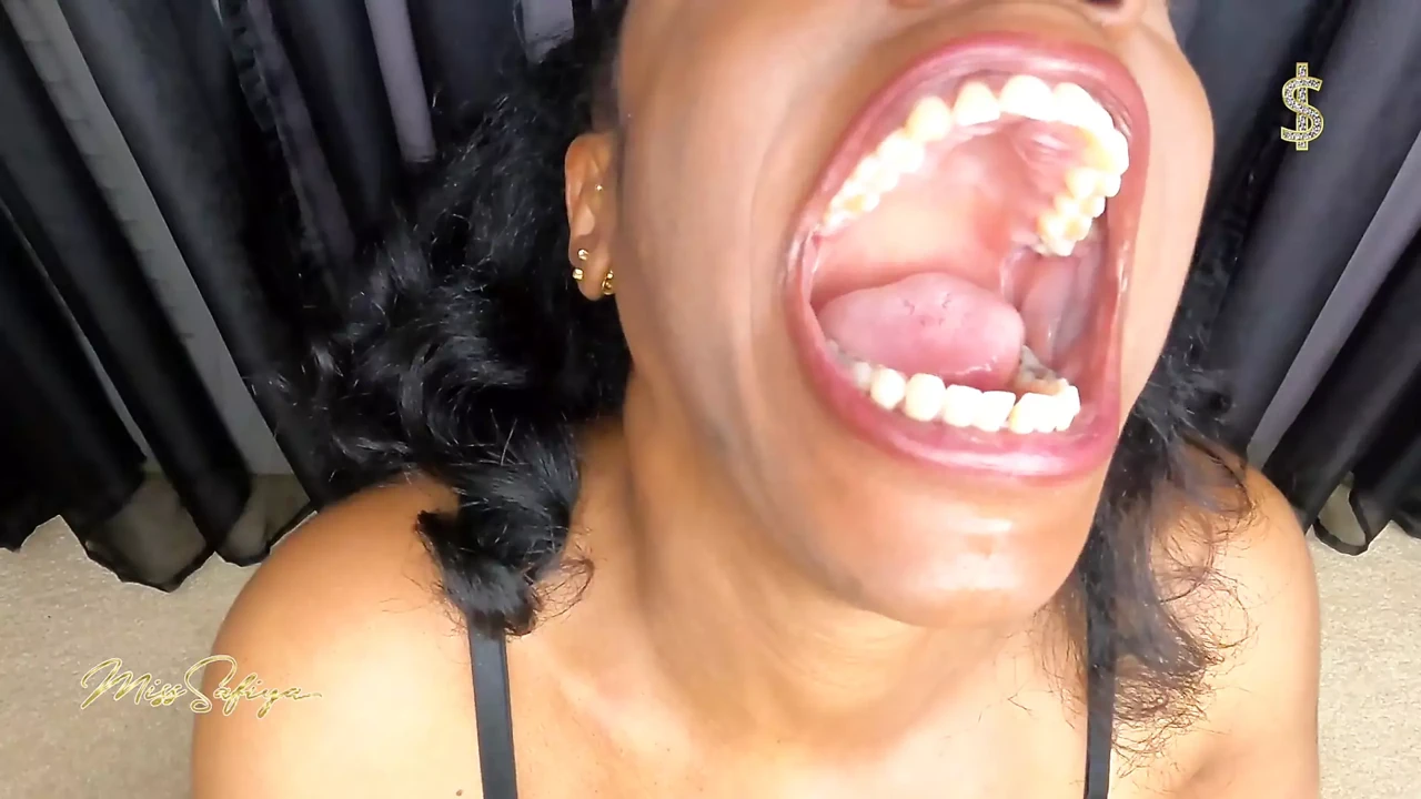 I'm ready for my mouth exam, custom